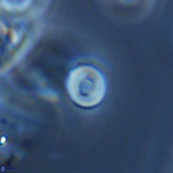 Pyrocyclus inversus VR 09558