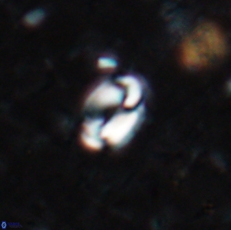 Pyrocyclus spiralis 19444