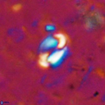 Pyrocyclus spiralis 19445