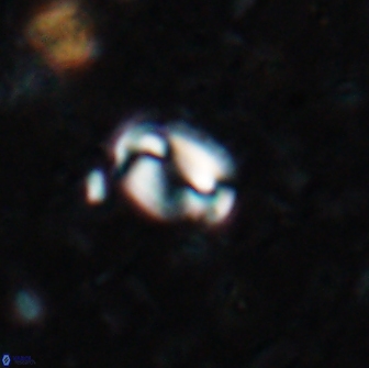 Pyrocyclus spiralis 19440