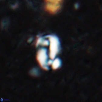 Pyrocyclus spiralis 19443