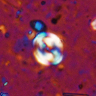 Pyrocyclus spiralis 19496