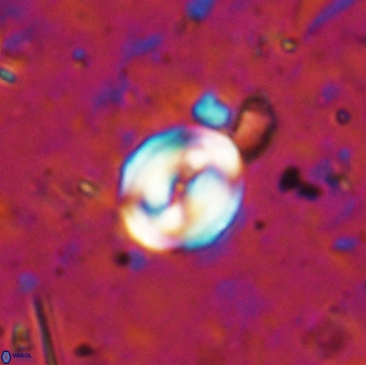 Pyrocyclus spiralis 19499