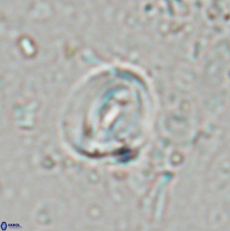 Pyrocyclus spiralis 27125