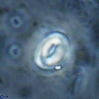 Pyrocyclus spiralis 27126