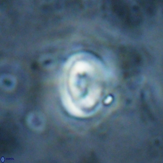 Pyrocyclus spiralis 27127