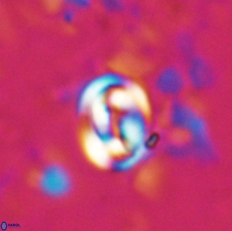 Pyrocyclus spiralis 27121