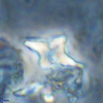 Quadrum blairiae 34099