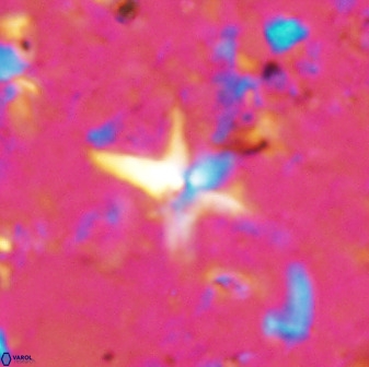Quadrum blairiae 37658