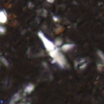 Quadrum blairiae 37660