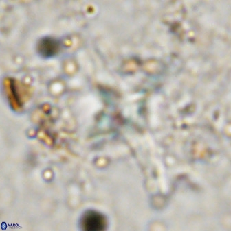 Quadrum blairiae 38414