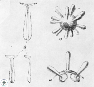 Rhabdosphaera clavigera 1075 15