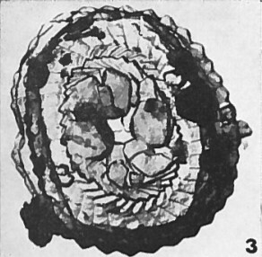 Reticulofenestra hesslandii 1485