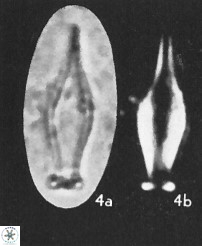 Rhabdosphaera inflata 25876