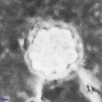 Assipetra terebrodentarius terebrodentarius 7111