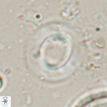 Reiculofenestra coenurus VR 024756