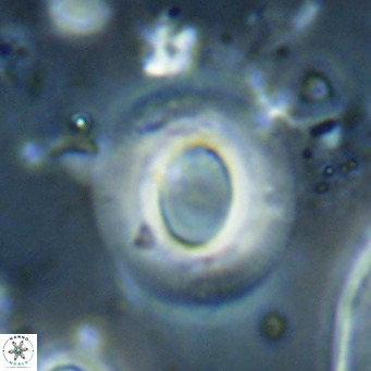 Reiculofenestra coenurus VR 024760