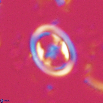 Reinhardtites anthophorus 15760