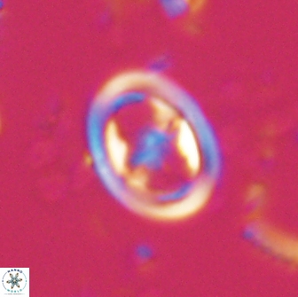 Reinhardtites anthophorus 15760