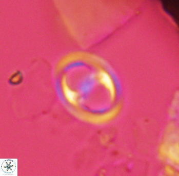 Reinhardtites anthophorus 3915