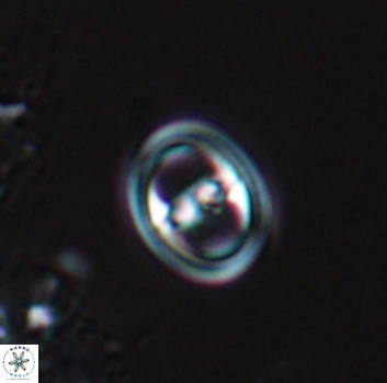 Diploteichus praesigmoides 9873