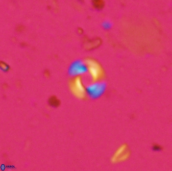 Retulofenestra dictyoda 30456