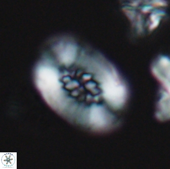 Retecapsa ficula 13816