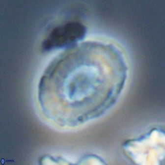 Retecapsa ficula 13824