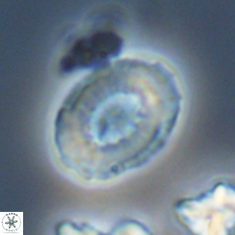 Retecapsa ficula 13824