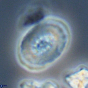 Retecapsa ficula 13825