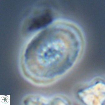 Retecapsa ficula 13825