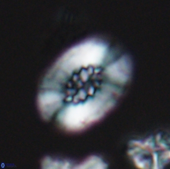 Retecapsa ficula 13820