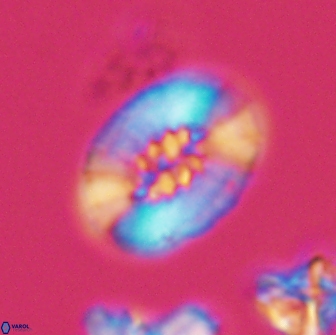 Retecapsa ficula 13821