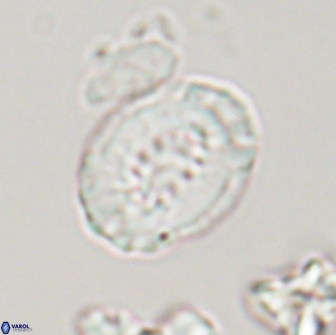 Retecapsa ficula 13822