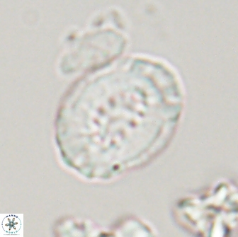 Retecapsa ficula 13822