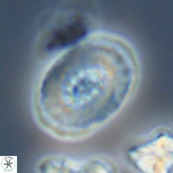 Retecapsa ficula 13823