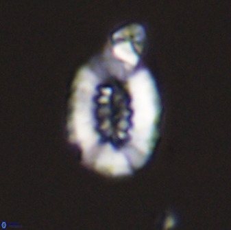 Retecapsa ficula 37354