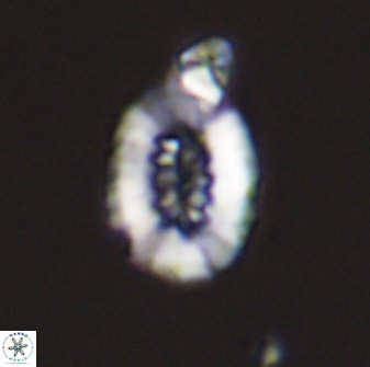 Retecapsa ficula 37354