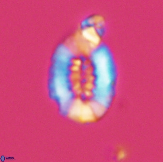 Retecapsa ficula 37355