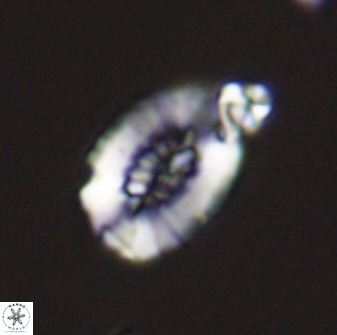 Retecapsa ficula 37356