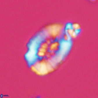 Retecapsa ficula 37357