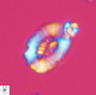 Retecapsa ficula 37357