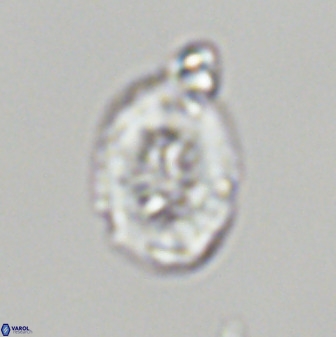 Retecapsa ficula 37358