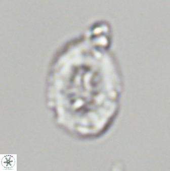 Retecapsa ficula 37358