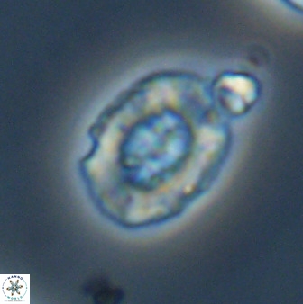 Retecapsa ficula 37359