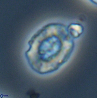 Retecapsa ficula 37360