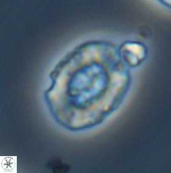 Retecapsa ficula 37360