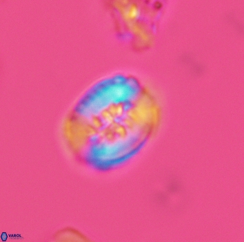 Retecapsa ficula 3145