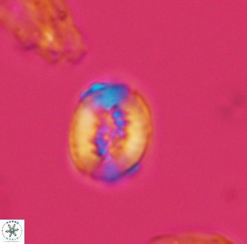 Retecapsa ficula 3146