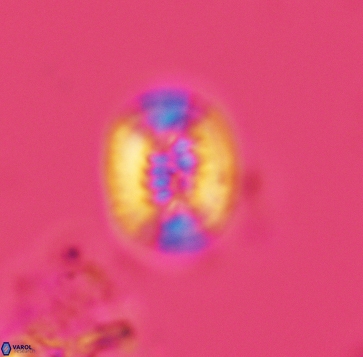 Retecapsa ficula 3247